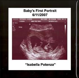 Photo Keepsake Box - Ultrasound Black